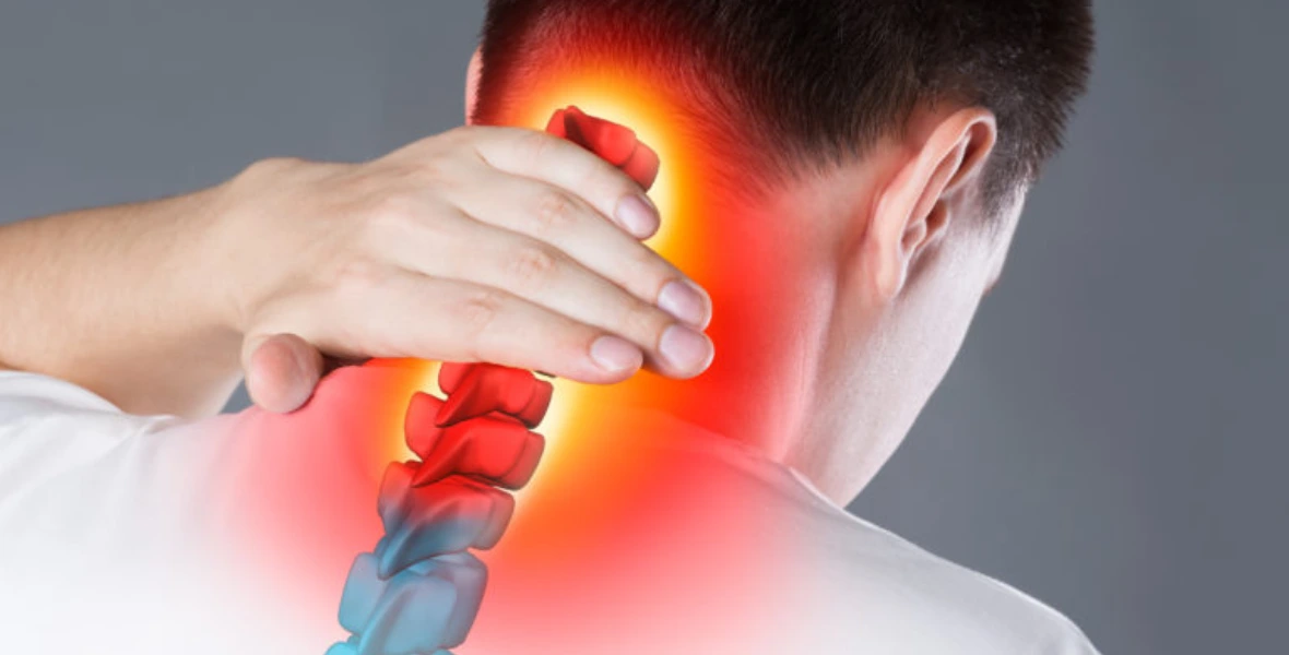 Cervical Disc Herniation
